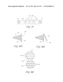 SYSTEM AND METHOD FOR PERCUTANEOUS PALATE REMODELING diagram and image