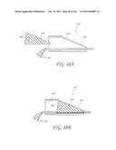 SYSTEM AND METHOD FOR PERCUTANEOUS PALATE REMODELING diagram and image