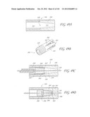 SYSTEM AND METHOD FOR PERCUTANEOUS PALATE REMODELING diagram and image