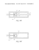 SYSTEM AND METHOD FOR PERCUTANEOUS PALATE REMODELING diagram and image