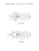 SYSTEM AND METHOD FOR PERCUTANEOUS PALATE REMODELING diagram and image