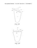 SYSTEM AND METHOD FOR PERCUTANEOUS PALATE REMODELING diagram and image