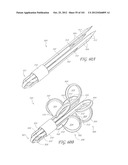 SYSTEM AND METHOD FOR PERCUTANEOUS PALATE REMODELING diagram and image