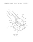 SYSTEM AND METHOD FOR PERCUTANEOUS PALATE REMODELING diagram and image