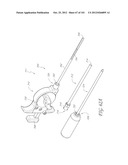 SYSTEM AND METHOD FOR PERCUTANEOUS PALATE REMODELING diagram and image