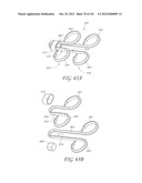 SYSTEM AND METHOD FOR PERCUTANEOUS PALATE REMODELING diagram and image