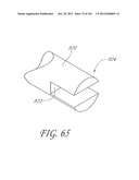 SYSTEM AND METHOD FOR PERCUTANEOUS PALATE REMODELING diagram and image