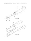 SYSTEM AND METHOD FOR PERCUTANEOUS PALATE REMODELING diagram and image