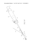 SYSTEM AND METHOD FOR PERCUTANEOUS PALATE REMODELING diagram and image