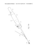 SYSTEM AND METHOD FOR PERCUTANEOUS PALATE REMODELING diagram and image