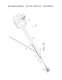 SYSTEM AND METHOD FOR PERCUTANEOUS PALATE REMODELING diagram and image