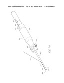 SYSTEM AND METHOD FOR PERCUTANEOUS PALATE REMODELING diagram and image