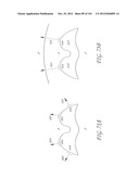 SYSTEM AND METHOD FOR PERCUTANEOUS PALATE REMODELING diagram and image