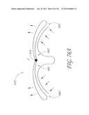 SYSTEM AND METHOD FOR PERCUTANEOUS PALATE REMODELING diagram and image