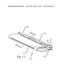 Squeegee Having at Least One Renewable Blade Surface For Treating a Target     Surface diagram and image