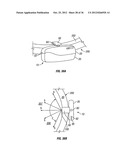 Automatic Toilet Bowl Treatment Device diagram and image