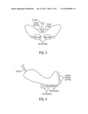 CONTROL SYSTEM FOR A REMOTE VEHICLE diagram and image