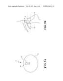 ASSISTIVE DEVICE FOR AIDING VISION CORRECTION AND REHABILITATION diagram and image