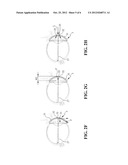 ASSISTIVE DEVICE FOR AIDING VISION CORRECTION AND REHABILITATION diagram and image