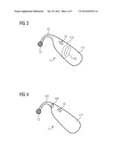 HEARING DEVICE WITH REDUCED ACOUSTIC FEEDBACK DUE TO VIBRATION-RELATED     SHORTENING OF THE HEARING DEVICE diagram and image