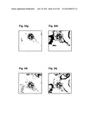 COMPLEX OF BI-SPECIFIC ANTIBODY AND DIGOXIGENIN CONJUGATED TO A     THERAPEUTIC OR DIAGNOSTIC AGENT diagram and image