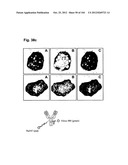 COMPLEX OF BI-SPECIFIC ANTIBODY AND DIGOXIGENIN CONJUGATED TO A     THERAPEUTIC OR DIAGNOSTIC AGENT diagram and image