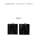 Adipose Stromal Stem Cells For Tissue And Vascular Modification diagram and image