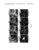 METHODS OF GENERATING NEURAL STEM CELLS diagram and image