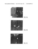 CARDIAC MUSCLE REPAIR OR REGENERATION USING BONE MARROW-DERIVED STEM CELLS diagram and image