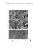 THERAPEUTIC AGENT FOR PULMONARY FIBROSIS diagram and image