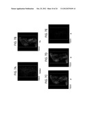 AMORPHOUS AND PARTIALLY AMORPHOUS NANOSCALE ION STORAGE MATERIALS diagram and image