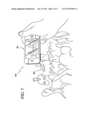 MOBILE ELECTRONIC DEVICE ACCESSORY AND METHOD OF PROVIDING THE SAME diagram and image