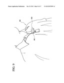 MOBILE ELECTRONIC DEVICE ACCESSORY AND METHOD OF PROVIDING THE SAME diagram and image