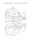 GOLF CLUB HEAD HAVING A STRESS REDUCING FEATURE diagram and image