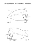 GOLF CLUB HEAD HAVING A STRESS REDUCING FEATURE diagram and image