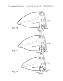 GOLF CLUB HEAD HAVING A STRESS REDUCING FEATURE diagram and image