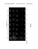 DRUG SELECTION FOR CANCER THERAPY BY PROFILING SIGNAL TRANSDUCTION     PROTEINS IN ASCITES OR PLEURAL EFFLUX SAMPLES diagram and image