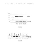 NATRIURETIC PEPTIDE RECEPTOR AS A BIOMARKER FOR DIAGNOSIS AND PROGNOSIS OF     CANCER diagram and image