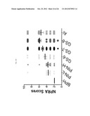 NATRIURETIC PEPTIDE RECEPTOR AS A BIOMARKER FOR DIAGNOSIS AND PROGNOSIS OF     CANCER diagram and image