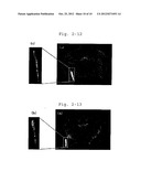 NOVEL COMPOUND HAVING AFFINITY FOR AMYLOID diagram and image