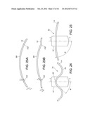 FLEXIBLE ELECTRODE ASSEMBLY FOR INSERTION INTO BODY LUMEN OR ORGAN diagram and image