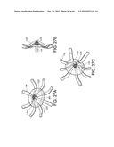 FLEXIBLE ELECTRODE ASSEMBLY FOR INSERTION INTO BODY LUMEN OR ORGAN diagram and image