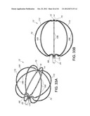 FLEXIBLE ELECTRODE ASSEMBLY FOR INSERTION INTO BODY LUMEN OR ORGAN diagram and image