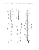 FLEXIBLE ELECTRODE ASSEMBLY FOR INSERTION INTO BODY LUMEN OR ORGAN diagram and image