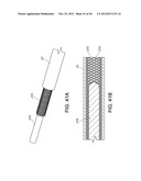 FLEXIBLE ELECTRODE ASSEMBLY FOR INSERTION INTO BODY LUMEN OR ORGAN diagram and image