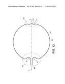 METHODS FOR DETECTION OF CARDIAC RHYTHM DISORDERS USING BASKET STYLE     CARDIAC MAPPING CATHETER diagram and image