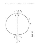 METHODS FOR DETECTION OF CARDIAC RHYTHM DISORDERS USING BASKET STYLE     CARDIAC MAPPING CATHETER diagram and image