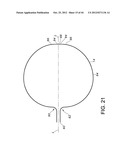 METHODS FOR DETECTION OF CARDIAC RHYTHM DISORDERS USING BASKET STYLE     CARDIAC MAPPING CATHETER diagram and image