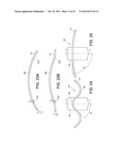 METHODS FOR DETECTION OF CARDIAC RHYTHM DISORDERS USING BASKET STYLE     CARDIAC MAPPING CATHETER diagram and image