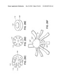 METHODS FOR DETECTION OF CARDIAC RHYTHM DISORDERS USING BASKET STYLE     CARDIAC MAPPING CATHETER diagram and image